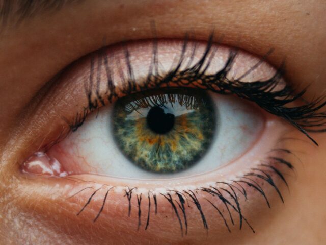 BLEPHAROPLASTY