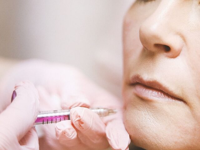 BOTULINUM TOXIN INJECTION