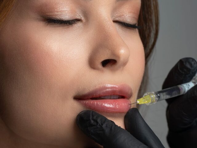 HYALURONIC ACID INJECTION (DERMAL FILLERS)
