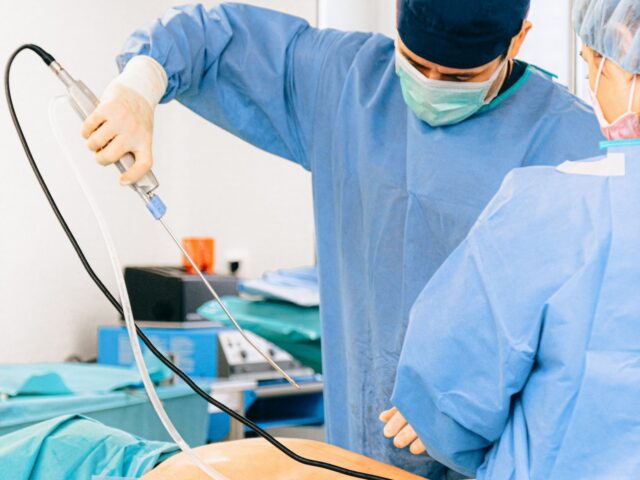 LIPOSUCTION