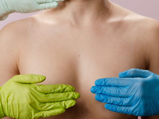 MAMMOPLASTY