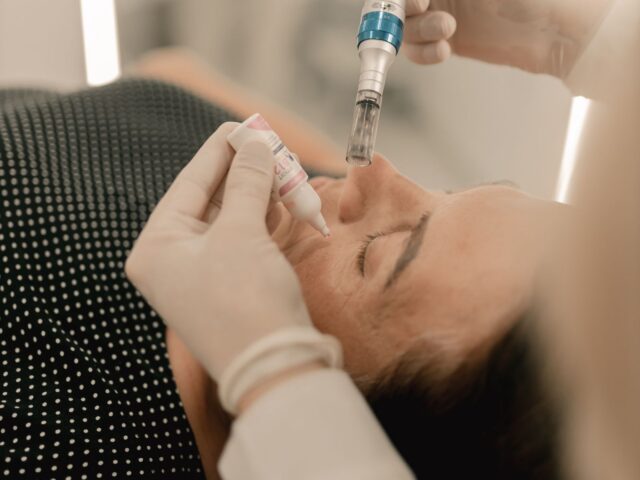 MESOTHERAPY / DERMA-ROLLING / MICRO-NEEDLING