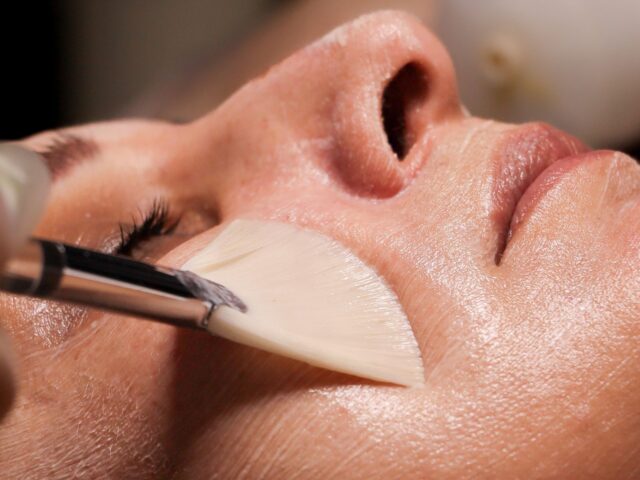 SKIN PEEL